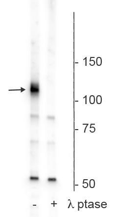 Western blot of rat hippocampal membrane lysate showing specific immunolabeling of the ~120 kDa Polo-Like Kinase Kinase phosphorylated at Ser482,486,490 in the first lane (-). Phosphospecificity is shown in the second lane (+) where the immunolabeling is completely eliminated by blot treatment with lambda phosphatase (λ-Ptase, 1200 units overnight).