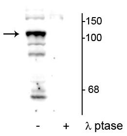 Western blot of mouse testicular lysate showing specific immunolabeling of the ~104 kDa PTPH1 phosphorylated at Ser459 in the first lane (-). Phosphospecificity is shown in the second lane (+) where the immunolabeling is completely eliminated by lysate treatment with lambda phosphatase (λ-Ptase , 400 units/100ul lysate for 30 minutes, RT).
