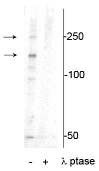 Western blot of mouse heart lysate showing specific immunolabeling of the ~250 kDa and ~150 kDa splice variants of the XIRP1 protein phosphorylated at Ser295 in the first lane (-). Phosphospecificity is shown in the second lane (+) where the immunolabeling is completely eliminated by blot treatment with lambda phosphatase (λ-Ptase, 1200 units for 30 minutes).