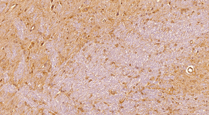 Immunostaining of a sagittal section of FFPE rat brain showing strong staining of oligodendrocyte precursor cells (OPC) in the hippocampus using our anti-NG2/CSPG4 (DAB, 1:200) and detected with anti-rabbit HRP. The section is counterstained with hematoxylin to identify DNA (blue).