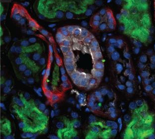 Immunofluorescence of healthy human kidney. The antibody specifically labels pre-pro-vasopressin (white) in the collecting ducts (DBA, red), but not in the proximal tubules (LTL, green) of human kidney. DNA is labeled with DAPI (blue). Image kindly provided by JP Arroyo, Vanderbilt University.