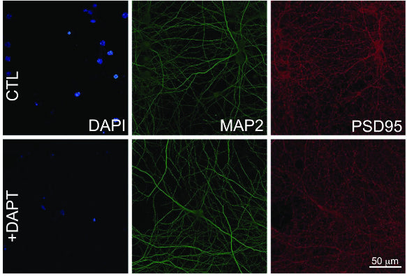 Representative confocal images of mouse cortical neurons using DAPI, MAP2, and PSD95 (cat. 75-028, 1:1000) in control conditions (upper images) and treated with DAPT inhibitor (lower images). Image from publication CC-BY-4.0. PMID:37059474