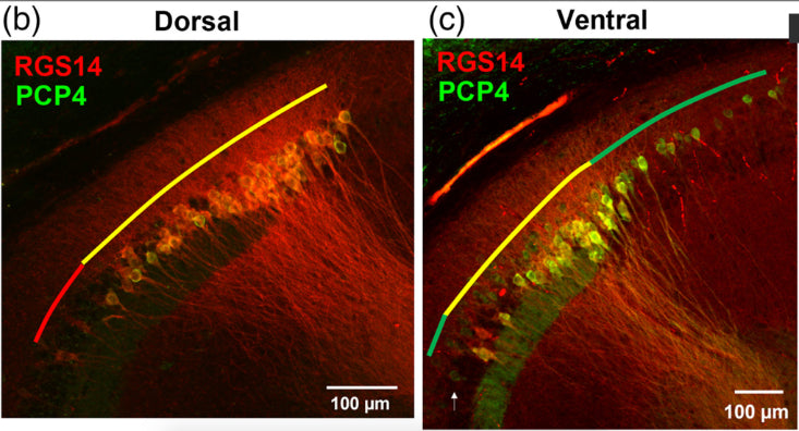 Representative images of RGS14 and PCP4 immunofluorescence. Colored lines indicate the RGS14+/PCP4+ double-labeled zone (DLZ) in yellow, with RGS14 (cat. 75-170, 1:500; red) and PCP4 (green) extension beyond the DLZ, in dorsal (b) and ventral (c) depths of mouse hippocampus. Image from publication CC-BY-4.0. PMID:36762588