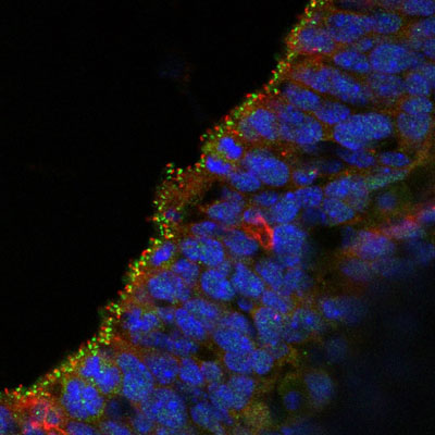 Immunofluorescence of the ventricular zone of E14 mouse brain (frozen section) labeled with Anti-Arl13b (red, Cat No. 75-287, 1:1000) and CEP152 (Green). The blue is DAPI staining of nuclear DNA. Image kindly provided by Koh-ichi Nagata, Nagoya University Graduate School of Medicine.