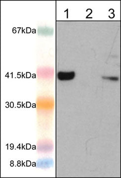 Western blot analysis of human Jurkat cells (lane 1), mouse macrophages untreated (lane 2) and treated (lane 3) with IFNγ (10 ng/ml) and LPS (1µg/ml) for 12 hr (20 µg/lane). The blot was probed with rabbit polyclonal anti-AIM2 (N-terminal region) antibody at 1:1000.