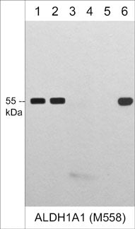 Western blot image of human A431 (lane 1), HepG2 (lane 2), PC3 (lane 3), Jurkat (lane 4), bovine tubulin (lane 5), and recombinant human ALDH1A1 (lane 6). The blot was probed with mouse monoclonal ALDH1A1 M558 (lanes 1-6) at a dilution of 1:1,000.