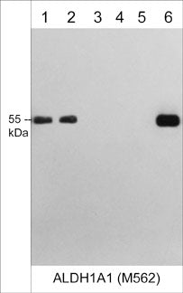 Western blot image of human A431 (lane 1), HepG2 (lane 2), PC3 (lane 3), Jurkat (lane 4), bovine tubulin (lane 5), and recombinant human ALDH1A1 (lane 6). The blot was probed with mouse monoclonal ALDH1A1 M562 (lanes 1-6) at a dilution of 1:1,000.