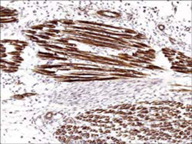 Formalin fixed, citric acid treated parafin sections of E18 mouse skeletal muscle. Sections were probed with anti-Actin (AM2021) then anti-Mouse:HRP before detection using DAB. (Images provided by Carl Hobbs and Dr. Pat Doherty at Wolfson Centre for Age-Related Diseases, King's College London).