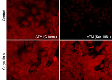 Immunocytochemical labeling of ATM phosphorylation in control (Top row) or calyculin A-treated A431 cells (Bottom row). The cells were labeled with mouse monoclonal ATM (C-terminal region) (AM3611) and ATM (Ser-1981) (AM3661). The antibodies were detected using goat anti-mouse-DyLight® 594.
