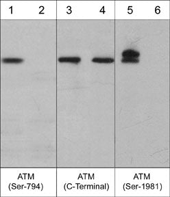 Western blot of human A431 cells treated with Calyculin A (100 nM) for 30 min. Blot lanes were untreated (lanes 1, 3, & 5) or treated with lambda phosphatase (lanes 2, 4, & 6) then probed with anti-ATM (Ser-794) (lanes 1 & 2), anti-ATM (C-Terminal) (lanes 3 & 4), or anti-ATM (Ser-1981) (lanes 5 & 6).