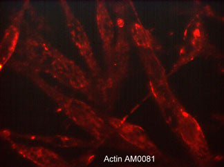 Immunocytochemical labeling of β-Actin in paraformaldehyde fixed human MeWo cells. The cells were labeled with mouse monoclonal anti-β-Actin (clone M008). The antibody was detected using goat anti-mouse DyLight® 594.