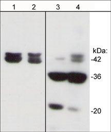 Western blot analysis of mouse C2C12 cells untreated (lanes 1 & 3), or treated with pervanadate (1 mM) for 30 min (lanes 2 & 4). The blot was probed with anti-Actin (N-terminal) antibody (lanes 1 & 2) or anti-Actin (Tyr-53) antibody (lanes 3 & 4).