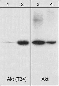Western blot analysis of A431 cells, serum starved overnight (20 µg/lanes 1 & 3) and calyculin A (100 nM) treated for 30 minutes (20 µg/lanes 2 & 4). The blot was probed with anti-Akt (Thr-34) (lanes 1 & 2) or anti-Akt1 (N-terminal region) (lanes 3 & 4).
