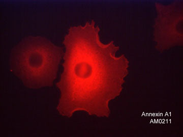Immunocytochemical labeling of Annexin A1 in paraformaldehyde fixed human A549 cells. The cells were labeled with mouse monoclonal anti-Annexin A1 (clone M021). The antibody was detected using goat anti-mouse Ig DyLight® 594.