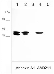 Western blot of human A431 cells (lane 1), A549 cells (lane 2), LNCaP cells (lane 3), full-length recombinant human annexin A1 (lane 4), and recombinant human annexin A2 (lane 5). The blot was probed with mouse monoclonal anti-Annexin A1 antibody (AM0211) at 1:1000 (lanes 1-5).