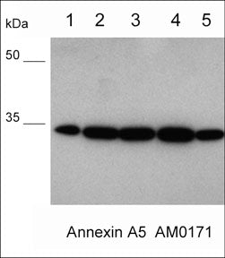 Western blot of human PC3 cells (lane 1), human breast tissue (lane 2), lung tissue (lane 3), skin tissue (lane 4), and brain tissue (lane 5). The blot was probed with mouse monoclonal anti-Annexin A5 antibody (AM0171) at 1:500 (lanes 1-5).