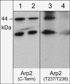 Immunocytochemical labeling of Arp2 phosphorylation in rat PC12 cells differentiated with NGF. The cells were probed with Arp2 (C-terminal region) and Arp2 (Thr-237/Thr-238) rabbit polyclonal antibodies, then the antibodies were detected using appropriate secondary antibody conjugated to Cy3.