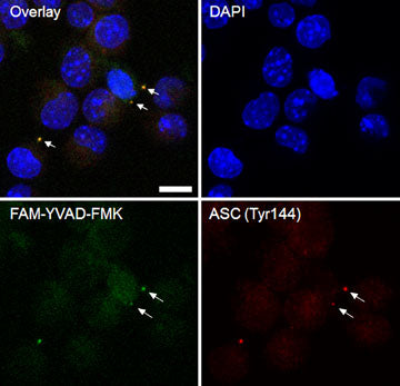Immunocytochemical labeling of Asc (Tyr-144) in inflammasomes. Paraformaldehyde fixed J774 cells were primed with LPS and treated with nigericin. Cells were co-labeled with DAPI, a caspase-1 inhibitor (FAM-YVAD-FMK), and anti-Asc (Tyr-144) phosphospecific antibody detected with AlexaFluor 568 secondary. (Image provided by Jordan Yaron, Center for Biosignatures Discovery Automation, Arizona State University)