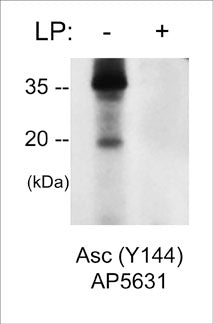 Western blot analysis of mouse macrophage J774A.1 cells stimulated with pervanadate (1 mM for 30 min.), then untreated (-) or treated (+) with alkaline phosphatase. The blot was probed with rabbit polyclonal anti-Asc (Tyr-144) phospho-specific antibody (AP5631) at 1:500.
