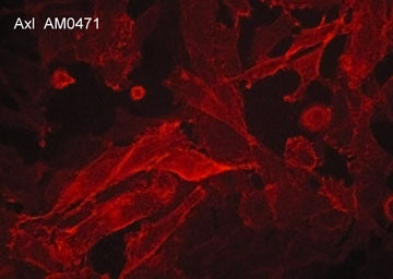 Immunocytochemical labeling of Axl in aldehyde fixed human MDAMB-231 breast carcinoma cells. The cells were labeled with mouse monoclonal anti-Axl (AM0471). The antibody was detected using goat anti-mouse DyLight® 594.