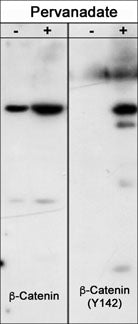 Western blot analysis of Hct116 src transformed cells (20 µg/lane) serum starved overnight or treated with pervanadate (1 mM) for 30 min. The blot was probed with anti-β-Catenin or anti-β-Catenin (Tyr-142)