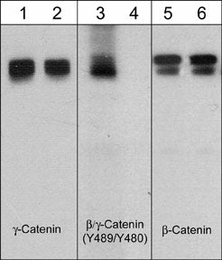 Western blot analysis of A431 cells stimulated with pervanadate (1 mM) for 30 min (lanes 1, 3, & 5) then treated with akaline phosphatase (lanes 2, 4, & 6). The blot was probed with anti-γ-Catenin (CM1111), anti-β-Catenin (Tyr-489) conserved site (CP2961), or anti-β-Catenin (CM1181).