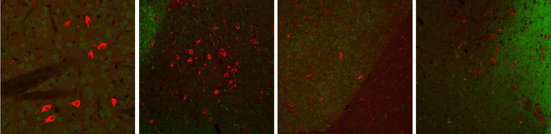 ChAT-immunoreactivity (RED) in cholinergic neurons within the mouse caudate nucleus in a paraformaldehyde-fixed (4%) paraffin-embedded section of a transgenic adult male C57Black6 mouse. The green staining is low-level GFP immunoreactivity in this transgenic animal. Dr. Felix Eckenstein, University of Vermont