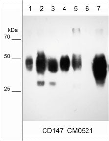 Western blot of lysates from SK-MES-1 squamous carcinoma (lane 1), MDA-MB-231 breast carcinoma (lane 2), MeWo melanoma (lane 3), A431 skin adenocarcinoma (lane 4), LNCaP prostate cancer cells (lane 5), MCF7 breast cancer cells (lane 6) and NCI-H1915
lung cancer cells. The blot was probed with
mouse monoclonal anti-CD147 (CM0521) at 1:1000.