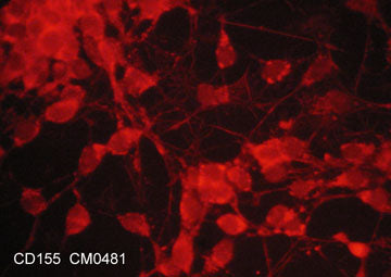 Immunocytochemical labeling of CD155 in aldehyde fixed and NP-40 permeabilized human NCI-H446 small cell lung carcinoma cells. The cells were labeled with mouse monoclonal anti-CD155 (CM0481). The antibody was detected using goat anti-mouse DyLight® 594.