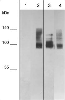 Western blot analysis of denatured (lanes 1 & 3) and native (lanes 2 & 4)  human MDA-MB-231 whole cell lysates. The blots were probed with mouse monoclonal anti-CD44 (CM5881) at 1:1000 (lanes 1 & 2) or mouse monoclonal anti-CD44 (CM5911) at 1:1000 (lanes 3 & 4).