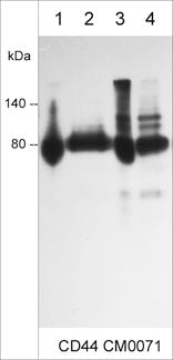 Immunocytochemical labeling of CD44 in paraformaldehyde fixed human A431 cells. The cells were labeled with mouse monoclonal anti-CD44 (clone M007). The antibody was detected using goat anti-mouse DyLight® 594.