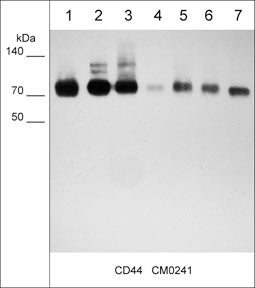 Immunocytochemical labeling of CD44 in paraformaldehyde fixed human MeWo cells. The cells were labeled with mouse monoclonal anti-CD44 (clone M024). The antibody was detected using goat anti-mouse DyLight® 594.