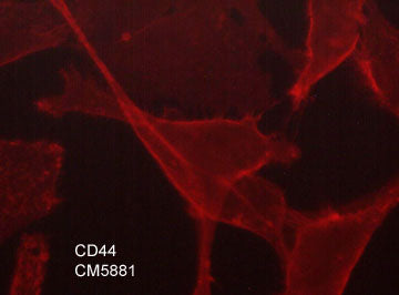Immunocytochemical labeling of CD44 in paraformaldehyde fixed human MDA-MB-231 cells. The cells were labeled with mouse monoclonal anti-CD44 (clone M588). The antibody was detected using goat anti-mouse DyLight® 594.