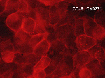 Immunocytochemical labeling of CD46 in aldehyde fixed human NCIH1915 lung carcinoma cells. The cells were labeled with mouse monoclonal anti-CD46 (CM0371). The antibody was detected using goat anti-mouse Ig:DyLight® 594.