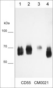 Immunocytochemical labeling of CD55 in paraformaldehyde fixed human MDA-MB-231 breast cancer cells. The cells were labeled with mouse monoclonal anti-CD55 (CM0021). The antibody was detected using goat anti-mouse DyLight® 594.