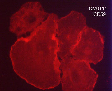 Immunocytochemical labeling of CD59 in paraformaldehyde fixed human A549 cells. The cells were labeled with mouse monoclonal anti-CD59 (clone M011). The antibody was detected using goat anti-mouse Ig DyLight® 594.