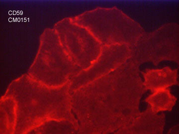 Immunocytochemical labeling of CD59 in paraformaldehyde fixed human A549 cells. The cells were labeled with mouse monoclonal anti-CD59 (clone M015). The antibody was detected using goat anti-mouse Ig DyLight® 594.