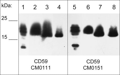 Western blot analysis of recombinant human CD59 protein (lanes 1 & 5), A431 (lanes 2 & 6), A549 (lanes 3 & 7), and MCF7 (lanes 4 & 8) whole cell lysates under native conditions. The blots were probed with mouse monoclonal anti-CD59 (CM0111) at 1:1000 (lanes 1-4) and anti-CD59 (CM0151) at 1:1000 (lanes 5-8).