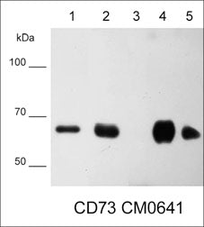 Western blot of native lysates including human CD73 recombinant protein (lane 1), NCI-H1915 lung carcinoma (lane 2), MeWo melanoma (lane 3), NCI-H1299 lung carcinoma (lane 4), and MDA-MB-231 breast carcinoma (lane 5). The blot was probed with mouse monoclonal anti-CD73 (CM0641) at 1:500.