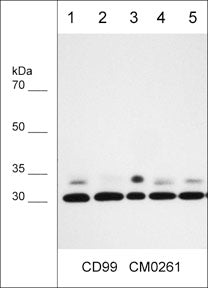 Western blot analysis of human cell lysates: A549 (lane 1), A431 (lane 2), LNCaP (lane 3), MDA-MB-231 (lane 4) and MeWo (lane 5). The blot was probed with mouse monoclonal anti-CD99 (CM0261) at 1:1000.