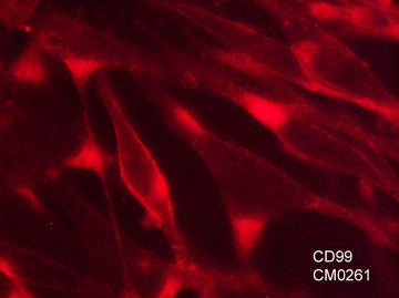 Immunocytochemical labeling of CD99 in paraformaldehyde fixed human MeWo cells. The cells were labeled with mouse monoclonal anti-CD99 (clone M026). The antibody was detected using goat anti-mouse DyLight® 594.