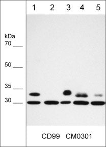 Immunocytochemical labeling of CD99 in paraformaldehyde fixed human MeWo cells. The cells were labeled with mouse monoclonal anti-CD99 (clone M030). The antibody was detected using goat anti-mouse DyLight® 594.
