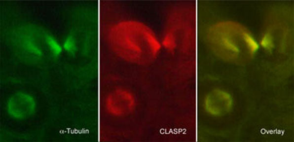 Immunocytochemical labeling of CLASP2 in paraformaldehyde-fixed and NP40-permeabilized A431 cells. The cells were dual labeled with mouse monoclonal anti-α-Tubulin (TM4111) (left)  and rat monoclonal anti-CLASP2 (CM5051) (middle). The antibodies were detected using either goat anti-mouse:DyLight® 488 (MS3011) or goat anti-Rat:DyLight® 594 (RS3111).