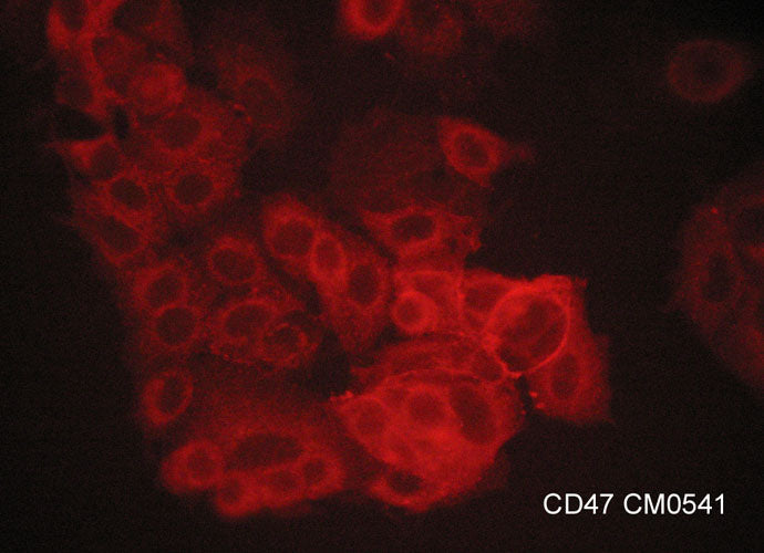 Immunocytochemical labeling of CD47 in aldehyde fixed human MCF7 breast carcinoma cells. The cells were labeled with mouse monoclonal anti-CD47 (CM0541). The antibody was detected using goat anti-mouse DyLight® 594.