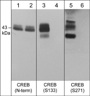 Western blot analysis of human A431 cells treated with calyculin A (100 nM) for 30 min. (lanes 1, 3 & 5) then the blots were treated with lambda phosphatase (lanes 2, 4 & 6). The blots were probed with anti-CREB (N-terminal region) (lanes 1 & 2), anti-CREB (Ser-133) (lanes 3 & 4), and anti-CREB (Ser-271) (lanes 5 & 6).