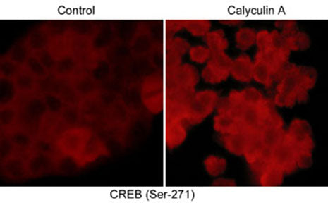 Immunocytochemical labeling of phosphorylated CREB in control and calyculin A-treated A431 cells. The cells were fixed in paraformaldehyde and permeabilized using NP-40 before labeling with rabbit polyclonal CREB (Ser-271). The antibody was detected using goat anti-rabbit DyLight® 594.