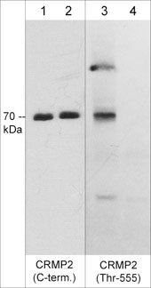 Western blot of rat PC12 cells stimulated with calyculin A (100 nM) for 30 min (lanes 1-4). Then the blot was treated with lambda phosphatase to dephosphorylate CRMP2 (lanes 2 & 4). The blot was probed with rabbit polyclonal anti-CRMP2 (C-terminal Region) antibody (lanes 1 & 2) or mouse monoclonal anti-CRMP2 (Thr-555) antibody (lanes 3 & 4).