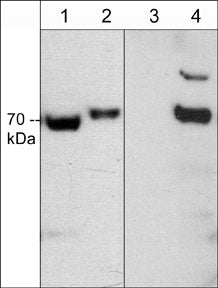 Western blot of rat PC12 cells untreated (lanes 1 & 3) or treated with calyculin A (lanes 2 & 4). The blot was probed with anti-CRMP2 (C-terminal Region) antibody (lanes 1 & 2) or anti-CRMP2 (Thr-555) antibody (lanes 3 & 4).