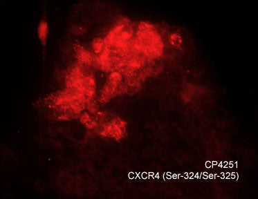 Immunocytochemical labeling of CXCR4 in chick pluripotent cells. The cells were labeled with rabbit polyclonal CXCR4 (S324/S325) antibody (CP4251), then detected using appropriate secondary antibody (Red). (Image provided by Dr. Yangqing Lu at the Regenerative Bioscience Center, University of Georgia).