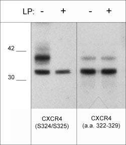 Western blot analysis of human Jurkat cells treated with 100 nM calyculin A for 30 min.  then the blots were untreated (-) or treated (+) with lambda phosphatase. The blots were probed with rabbit polyclonals anti-CXCR4 (Ser-324/Ser-325) (left panel) or anti-CXCR4 (a.a. 322-329) (right panel).